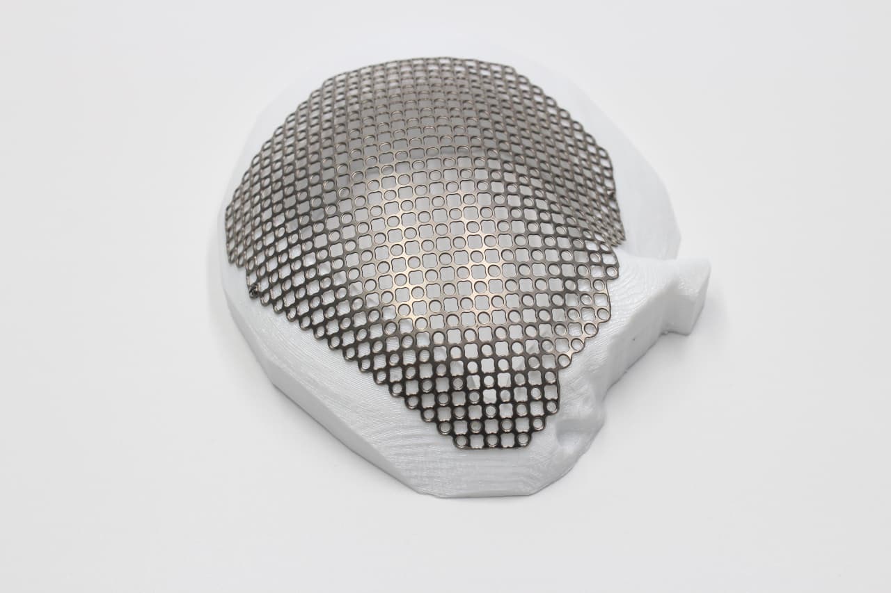 Implan titanium mesh berbentuk kranial